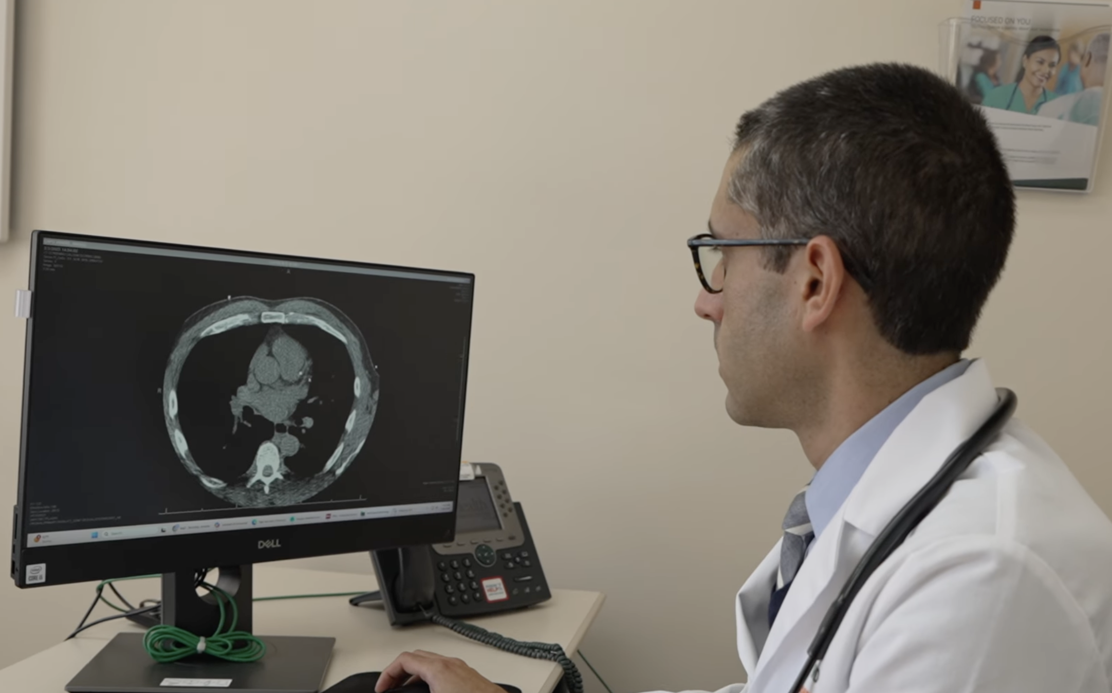 A Simple Calcium Screening to Better Know Your Heart
                